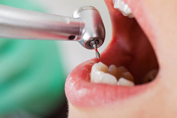 Best Mobile Emergency Dentist in Collinsville, AL